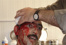IRAN: Molte vittime nel feroce attacco a Camp Ashraf Image