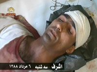 Iran: Lo stato dei feriti di Ashraf e quelli presi in ostaggio dalle forze irachene peggiora Image