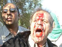 Attacco all’ ospedale di Ashraf, decine di Mojahedin del popolo feriti