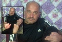 Iran – Diritti Umani: Un prigioniero chiede che i mullah vengano perseguiti per la sua doppia amputazione