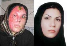Iran: le aggressioni con l’acido continuano. Colpita una donna di 24 anni ad Isfahan